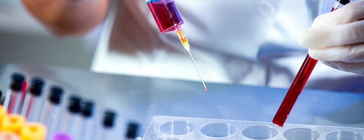 Abertas inscrições para o IX Simpósio Internacional de Atualização em Temas de Hematologia