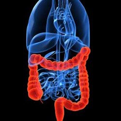 Câncer colorretal, obesidade e risco de segundo câncer